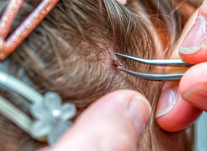 Festklammern oder anspringen?