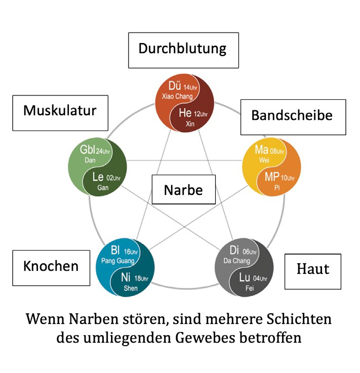 Störende Narben